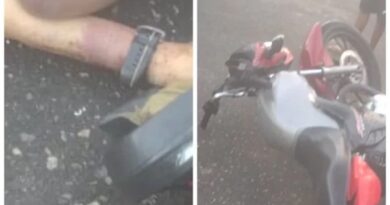 Homem é encontrado morto com marcas de espancamento em Pituaçu